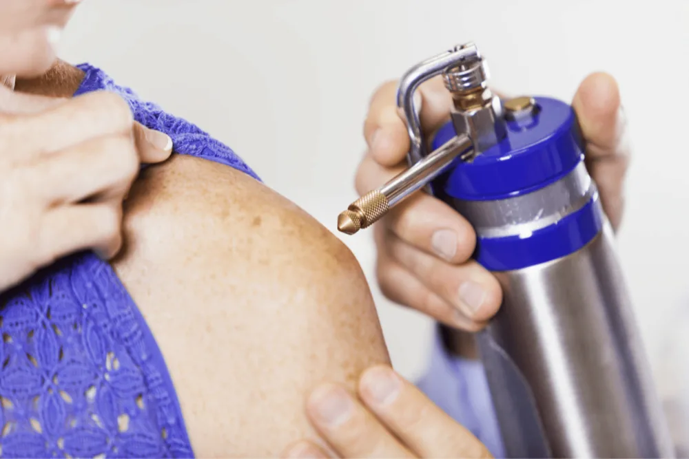 Cryotherapy treatment