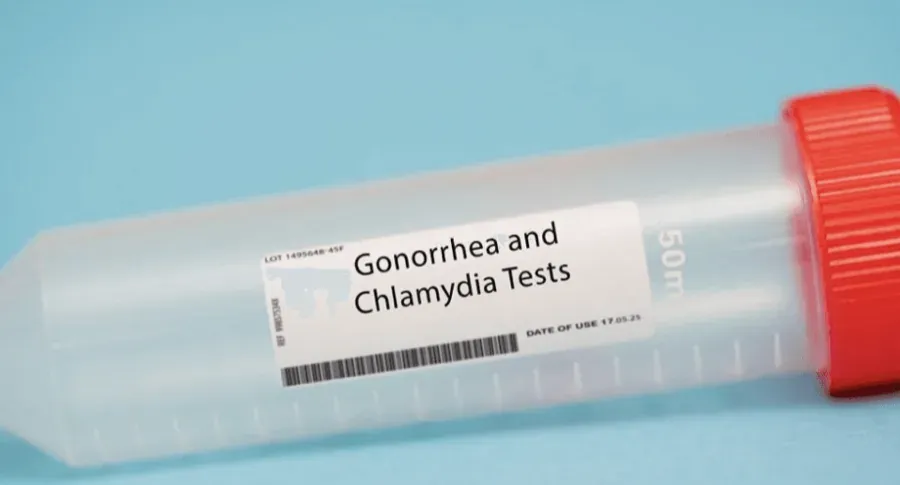 Chlamydia & Gonorrhoea Test