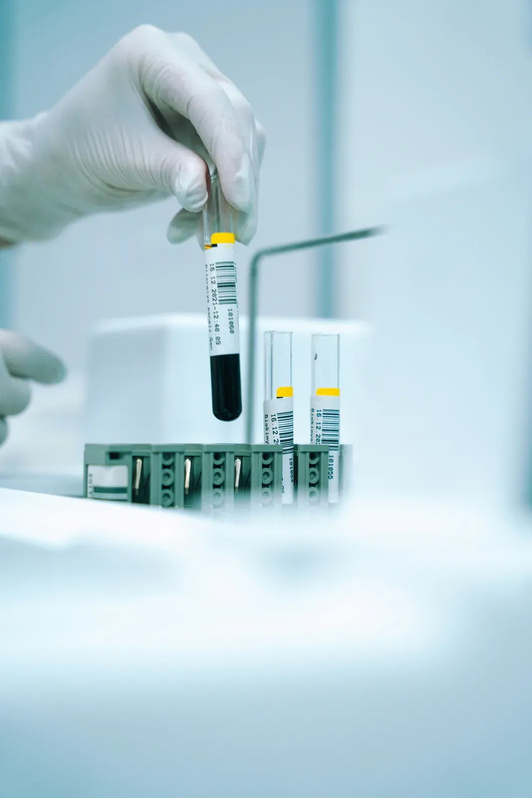 Blood Tests
